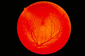 Human retina