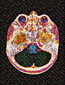 Mosaic of Brain MRI