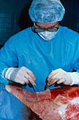 Skin Graft Operation