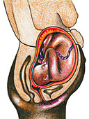 Fetal Development - Month 9