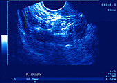 Ovary