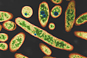 Legionnaires' disease bacteria