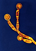 Candida chlamydospore