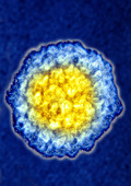 TEM of HPV