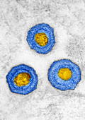 TEM of Herpes Simplex Virus