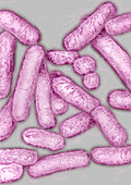 Legionella bacteria,TEM