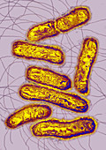 Salmonella bacteria,TEM