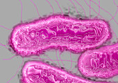 Salmonella bacteria,TEM