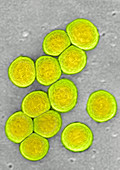 Staphylococcus aureus,TEM