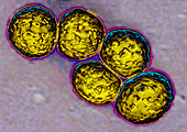 Staphylococcus aureus,TEM