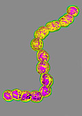 Streptococcus pyogenes ,TEM
