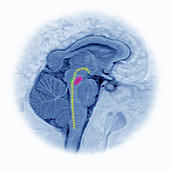 Brain Stem With Sleep Stages