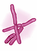 Mycobacterium tuberculosis,LM