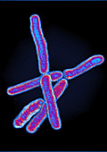 Mycobacterium tuberculosis,LM