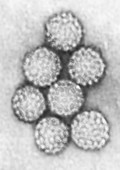 TEM of Polyomavirus
