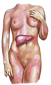 Female Body With Liver