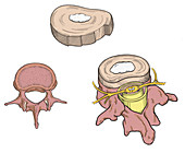 Illustration of Spinal Disks