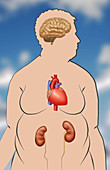 Main risk factors of obesity