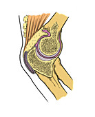 Illustration of Right Elbow Joint
