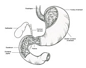 Illustration of Stomach and Duodenum