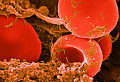 Red Blood Cells,SEM