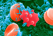 Red Blood Cells and Acanthocyte,SEM