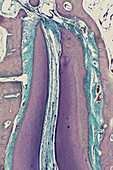 Developing Tooth,LM