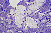 Submandibular Salivary Gland,LM