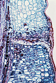 LM of Dicotyledon leaf (Sambucus)