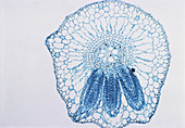 LM of Dicotyledon Root (Eichhornia)