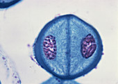 LM of Meiosis in Pollen Mother Cell - 5