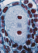 LM of Ovary for Young Ovules in Lilium