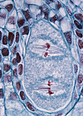 LM of Ovary for Young Ovules in Lilium