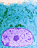 Epithelial Cell,TEM