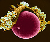 Egg Cell in Hamster,SEM