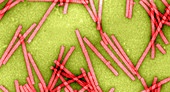 Tobacco Mosaic Virus,TEM