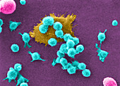 Cancer Cell Death,SEM (2 of 6)