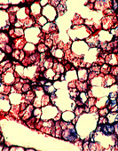 Healthy lung tissue,light micrograph