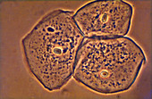 Human cheek cells,light micrograph