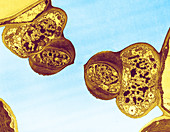 Stoma and Guard Cells,TEM