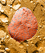 Nuclear Pores of Pig Kidney (TEM)