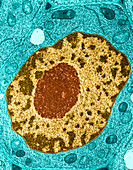 Nucleus in Root Tip Cell,TEM