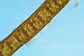 Pilayella sp. Algae,LM