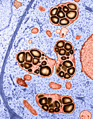 Arabidopsis Amyloplasts