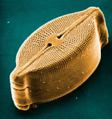 Diatom (Navicula perpusilla)