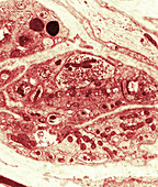 Synapse in Ganglion (TEM)