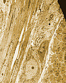 TEM of Auerbach's Nerve Plexus