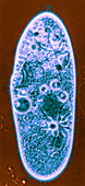 Paramecium (LM)