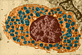 Mast Cells,TEM