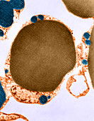 White Adipose Cell (TEM)